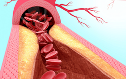 Kurkuma: Kaikki mitä sinun tulee tietää