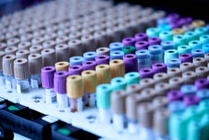 P-Kol: Mitä se tarkoittaa verikokeissa?