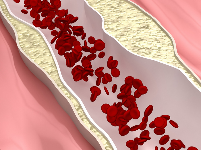 Rosuvastatin 5 mg kokemuksia