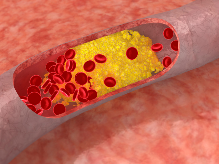 Keramidit ja kolesteroli – näkymätön yhteys aineenvaihdunnan ja sydänterveyden välillä